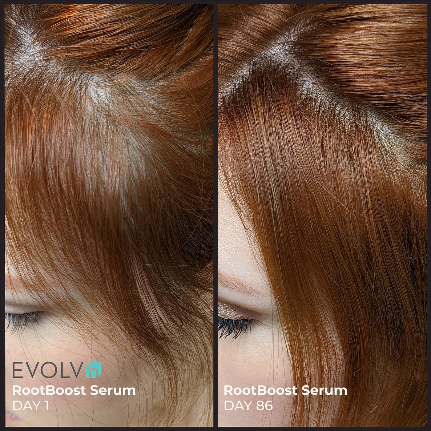 EVOLVh Better Roots RootBoost Serum 4 EVOLVh Better Roots RootBoost Serum - Image 2